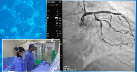 Live Case - Cathpax AIR - GISE- Dr Bernardo Cortese - Lemer Pax